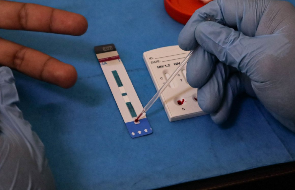 ONU advierte riesgo de resurgimiento del VIH por falta de recursos