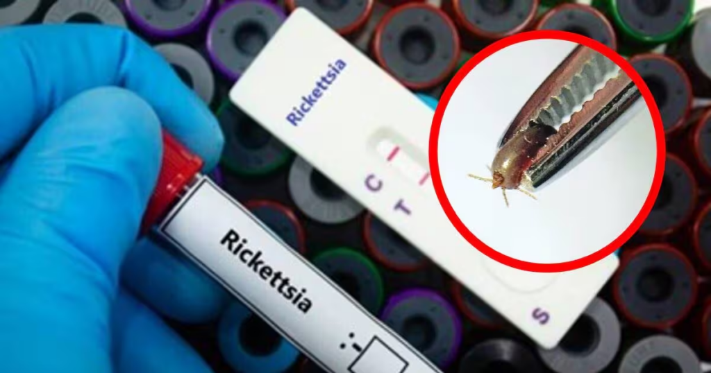 Secretaría de Salud alerta por incremento de rickettsiosis